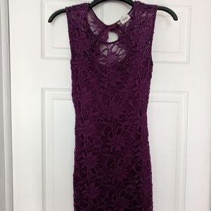 Tobi Lace Dress